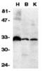 TNF Receptor Superfamily Member 6b antibody, A04048-1, Boster Biological Technology, Western Blot image 