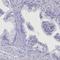 Ankyrin repeat domain-containing protein 2 antibody, HPA040842, Atlas Antibodies, Immunohistochemistry paraffin image 