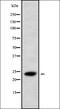 Hematopoietic Prostaglandin D Synthase antibody, orb338330, Biorbyt, Western Blot image 