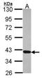 11-cis retinol dehydrogenase antibody, NBP2-15097, Novus Biologicals, Western Blot image 