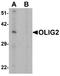 Oligodendrocyte Transcription Factor 2 antibody, A02247-1, Boster Biological Technology, Western Blot image 