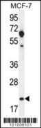 hCG_1646420 antibody, 56-242, ProSci, Western Blot image 