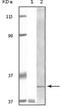 BLK Proto-Oncogene, Src Family Tyrosine Kinase antibody, abx015723, Abbexa, Enzyme Linked Immunosorbent Assay image 