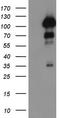 Progesterone Receptor antibody, TA802609BM, Origene, Western Blot image 