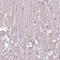 Aldehyde Dehydrogenase 2 Family Member antibody, HPA051065, Atlas Antibodies, Immunohistochemistry paraffin image 