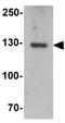 Myosin-binding protein C, slow-type antibody, GTX32053, GeneTex, Western Blot image 