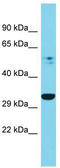 Proteasome 26S Subunit, Non-ATPase 7 antibody, TA342590, Origene, Western Blot image 