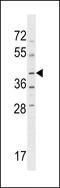 NPR2 Like, GATOR1 Complex Subunit antibody, 58-740, ProSci, Western Blot image 