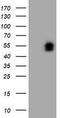 LIM Homeobox 1 antibody, TA504530S, Origene, Western Blot image 