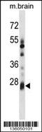 Potassium Channel Tetramerization Domain Containing 6 antibody, 58-658, ProSci, Western Blot image 