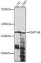 N-Acetylglucosamine-1-Phosphate Transferase Subunits Alpha And Beta antibody, 16-308, ProSci, Western Blot image 