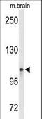 Lon Peptidase 2, Peroxisomal antibody, LS-B13125, Lifespan Biosciences, Western Blot image 