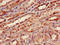 High molecular weight kininogen antibody, A52165-100, Epigentek, Immunohistochemistry paraffin image 