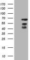 Mitogen-activated protein kinase kinase kinase 8 antibody, TA808390S, Origene, Western Blot image 
