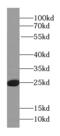 Ras-related protein Rab-27A antibody, FNab07011, FineTest, Western Blot image 