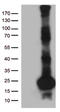 SCP2 Sterol Binding Domain Containing 1 antibody, LS-C796475, Lifespan Biosciences, Western Blot image 