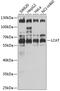 Lecithin-Cholesterol Acyltransferase antibody, 19-222, ProSci, Western Blot image 