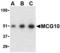 Poly(RC) Binding Protein 4 antibody, A11870, Boster Biological Technology, Western Blot image 