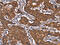 G protein-activated inward rectifier potassium channel 3 antibody, CSB-PA229005, Cusabio, Immunohistochemistry frozen image 