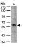 PML antibody, PA5-28720, Invitrogen Antibodies, Western Blot image 