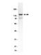 Protein Phosphatase 1 Regulatory Subunit 9B antibody, GTX18561, GeneTex, Western Blot image 