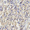Killer Cell Lectin Like Receptor D1 antibody, LS-C331847, Lifespan Biosciences, Immunohistochemistry paraffin image 