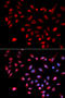 Cyclin Dependent Kinase 9 antibody, 16-157, ProSci, Immunofluorescence image 
