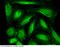 ADP Ribosylation Factor Like GTPase 2 Binding Protein antibody, 14357-R001, Sino Biological, Immunohistochemistry paraffin image 