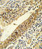 CYP51A1 antibody, LS-C167243, Lifespan Biosciences, Immunohistochemistry frozen image 