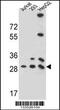 Phosphoglycerate Mutase Family Member 4 antibody, 57-004, ProSci, Western Blot image 