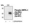Protein Kinase AMP-Activated Catalytic Subunit Alpha 2 antibody, PA5-17543, Invitrogen Antibodies, Western Blot image 