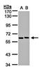 5'-Nucleotidase, Cytosolic II antibody, orb69807, Biorbyt, Western Blot image 