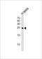 IZUMO Family Member 2 antibody, PA5-49355, Invitrogen Antibodies, Western Blot image 