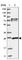 Glutathione S-transferase Mu 3 antibody, HPA035190, Atlas Antibodies, Western Blot image 