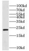 KH Domain Containing 3 Like, Subcortical Maternal Complex Member antibody, FNab04522, FineTest, Western Blot image 