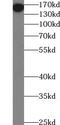 UHRF1 Binding Protein 1 Like antibody, FNab09246, FineTest, Western Blot image 