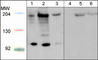 Roundabout Guidance Receptor 1 antibody, RP2791, ECM Biosciences, Western Blot image 