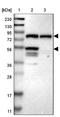 Intraflagellar Transport 81 antibody, NBP1-84558, Novus Biologicals, Western Blot image 