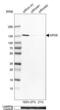 Exportin-5 antibody, NBP1-89606, Novus Biologicals, Western Blot image 