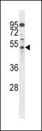 AP-2 complex subunit mu antibody, LS-C156389, Lifespan Biosciences, Western Blot image 