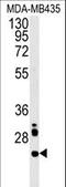 LHFPL Tetraspan Subfamily Member 3 antibody, LS-C165762, Lifespan Biosciences, Western Blot image 