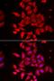 Tropomodulin 4 antibody, LS-C334935, Lifespan Biosciences, Immunofluorescence image 