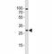 Oligodendrocyte Transcription Factor 1 antibody, F53004-0.4ML, NSJ Bioreagents, Western Blot image 