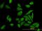 Mitotic checkpoint serine/threonine-protein kinase BUB1 beta antibody, LS-C104868, Lifespan Biosciences, Immunofluorescence image 