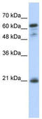 Germinal Center Associated Signaling And Motility antibody, TA330926, Origene, Western Blot image 