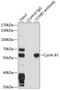 Methylosome subunit pICln antibody, 16-392, ProSci, Immunohistochemistry paraffin image 