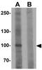 Family With Sequence Similarity 193 Member B antibody, GTX32081, GeneTex, Western Blot image 