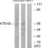 5-Hydroxytryptamine Receptor 1B antibody, LS-C120543, Lifespan Biosciences, Western Blot image 