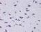 Diencephalon/Mesencephalon Homeobox 1 antibody, A10724, Boster Biological Technology, Immunohistochemistry paraffin image 