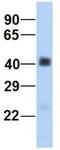 Sarcoglycan Beta antibody, NBP1-59751, Novus Biologicals, Western Blot image 